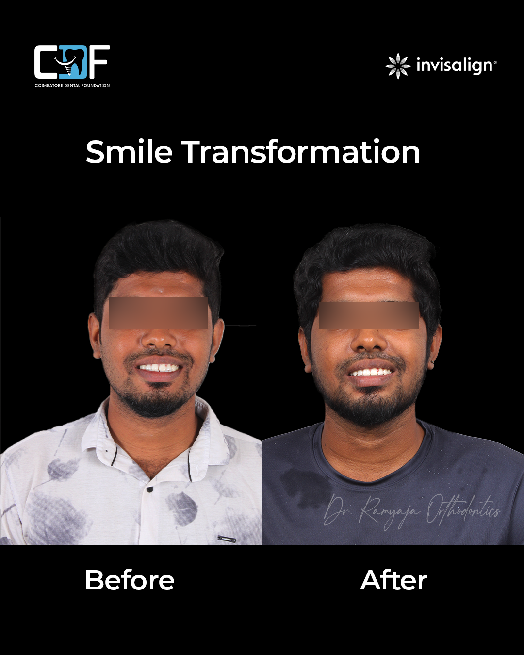Before After Result